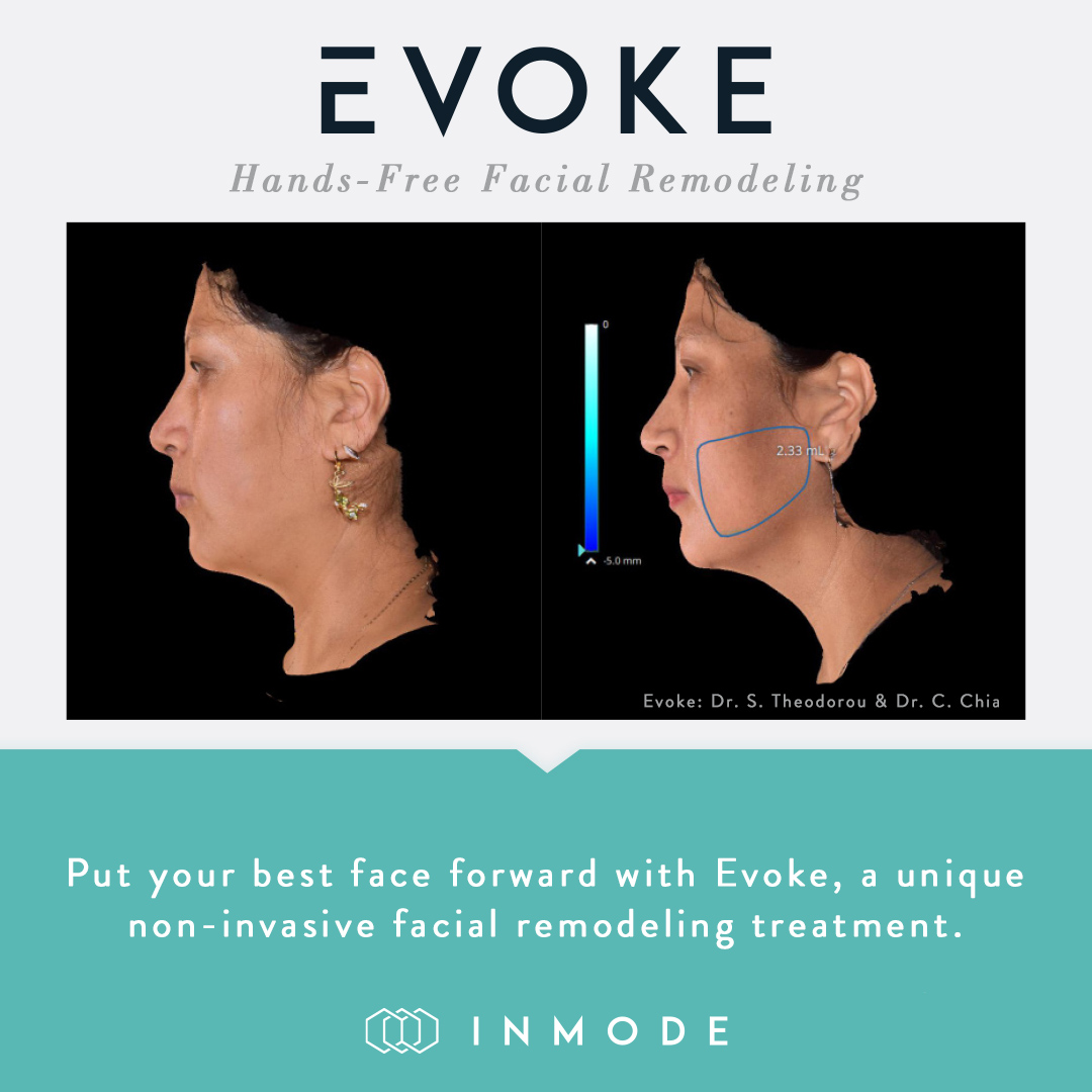 A woman 's face with an image of the side of her head and neck.
